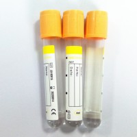 Vacuum Blood Collecting Tubes, Gel and Clot Activator Tube